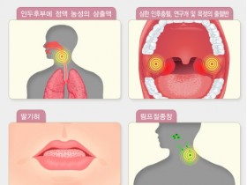 광주지역 성홍열 급증…5년새 5.9%→74.4%